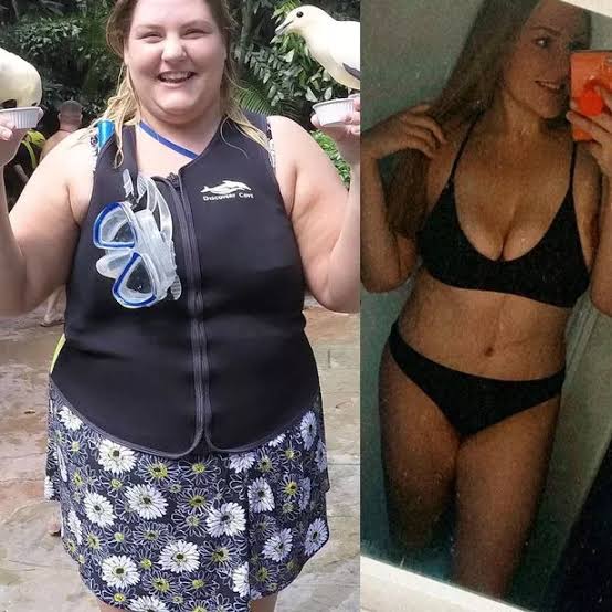 Retatrutide revolution